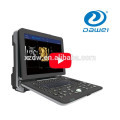 DW-C300 nouvelle version portable 4D doppler couleur machine à ultrasons